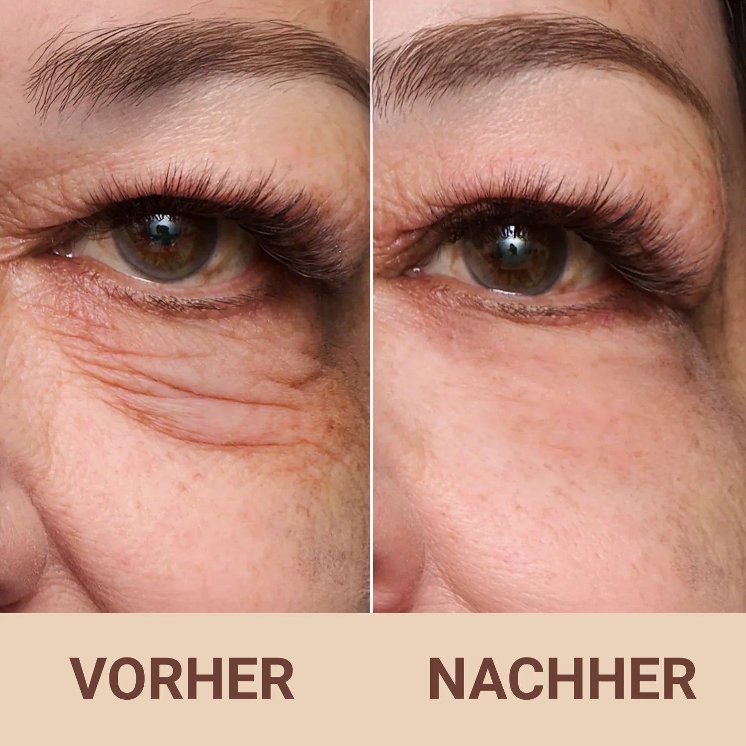 Vita-A Retinal Shot™ Verstevigingsbooster