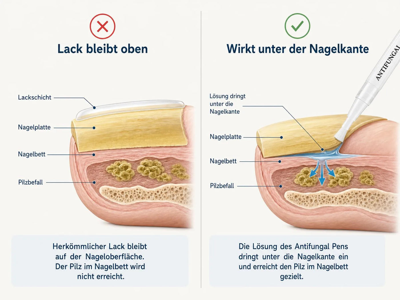 Warum ausgerechnet die „starken" Mittel scheitern mussten