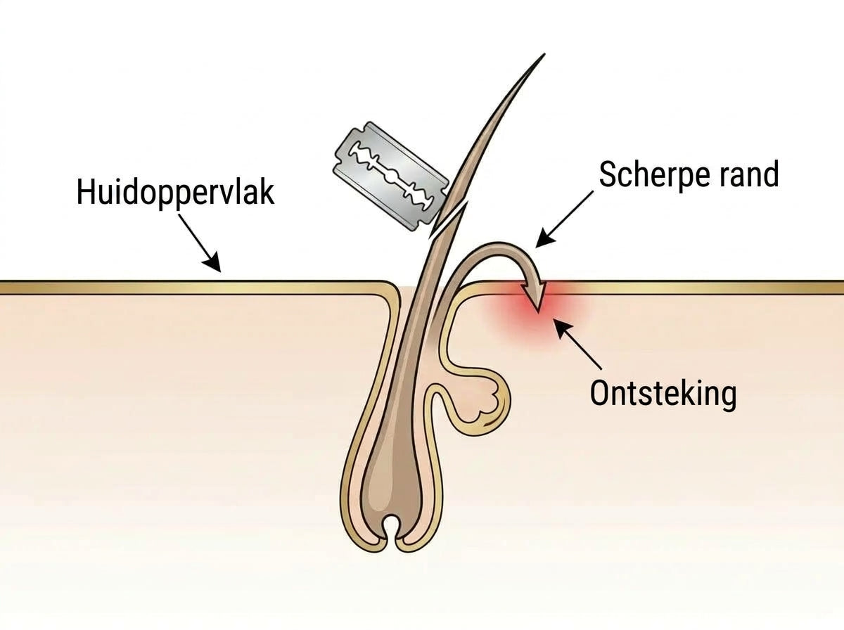 Jouw huid na het scheren: een open deur voor bacteriën