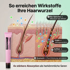 Rosemary PDRN Spicule Hoofdhuidserum™ – Bio-microneedling-behandeling voor haargroei